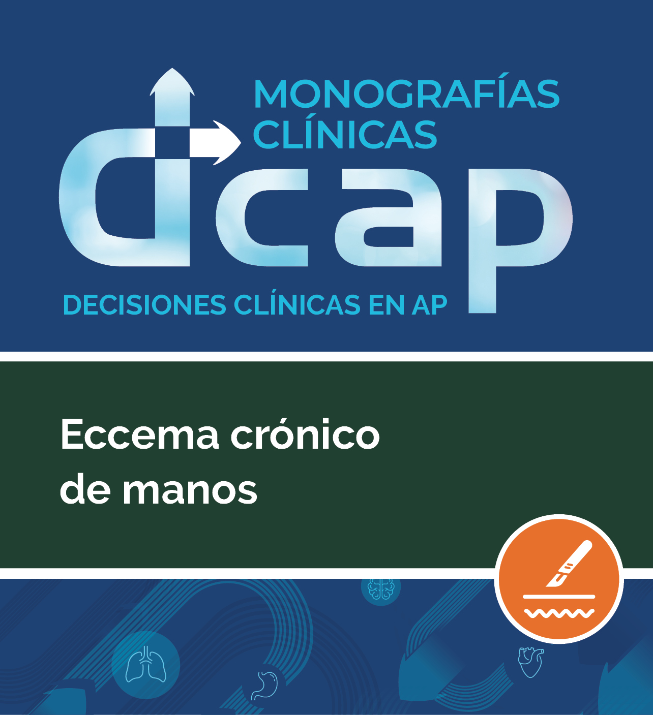 DCAP. Decisiones en la consulta de AP: Eccema crónico de manos 
