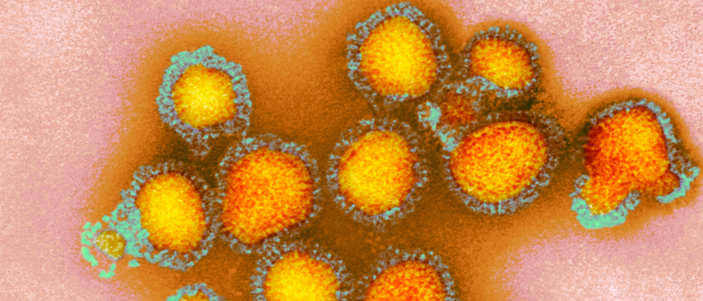La semFYC advierte de un adelanto de la epidemia de gripe y COVID-19 y de la posible circulación del subclado K del virus gripal H3N2