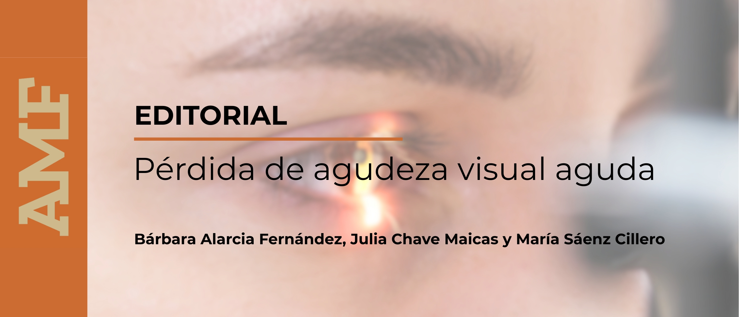 Actuar a tiempo ante una pérdida visual aguda puede evitar secuelas irreversibles