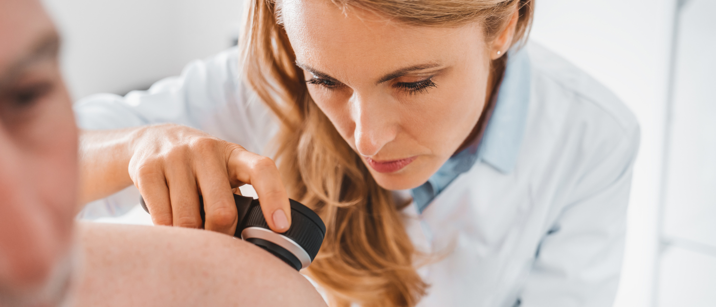 El papel de médicos y médicas de familia en la detección del melanoma y el potencial de la dermatoscopia