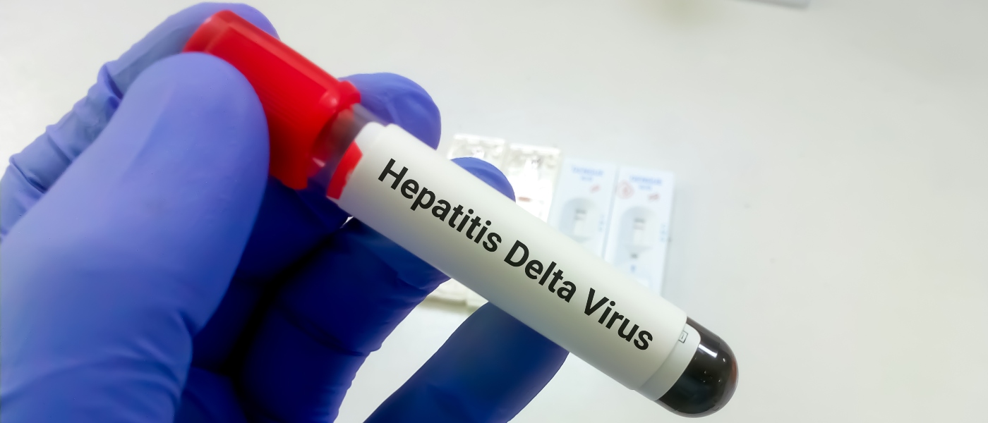 El primer consenso sobre hepatitis Delta (VHD) advierte de que entre el 30% y el 50% de los pacientes presenta cirrosis en el momento del diagnóstico