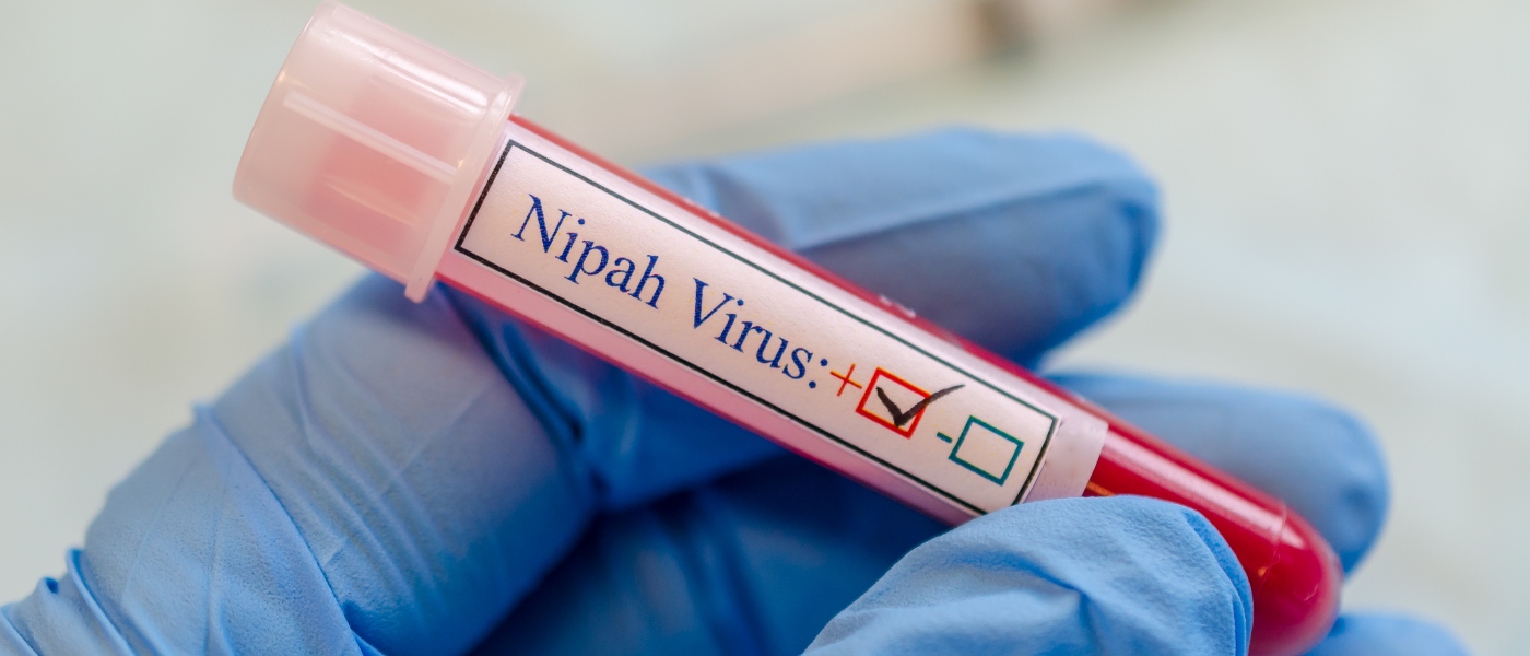 El virus Nipah vuelve a la actualidad en el Día Mundial de las Enfermedades Tropicales Desatendidas