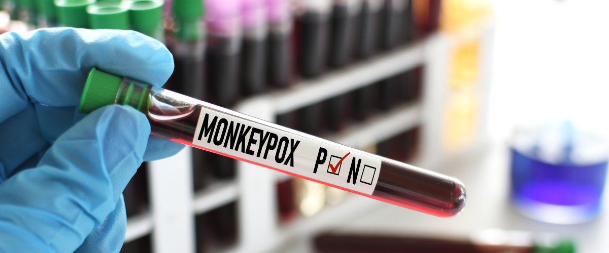 #HemosLeído: Una revisión sobre la viruela del mono o ‘monkeypox’