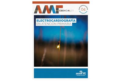 Electrocardiografía en Atención Primaria - AMF esenciales (para especialistas en personas)