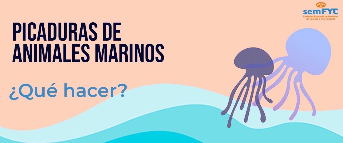Todo lo que necesitas saber sobre picaduras de animales marinos: medusas, pez araña, erizos…